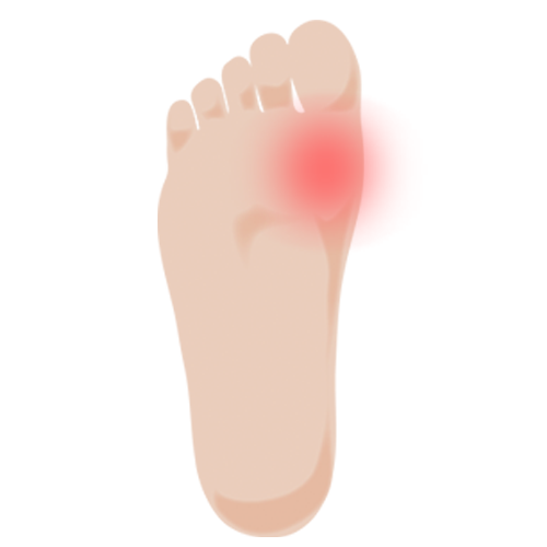 外反母趾 足の痛み 専門 整足院田園調布店
